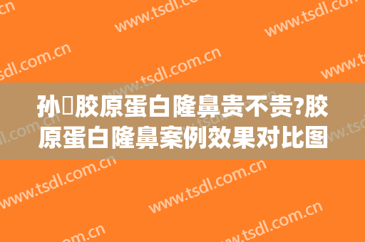 孙燚胶原蛋白隆鼻贵不贵?胶原蛋白隆鼻案例效果对比图_浙江省人民医院