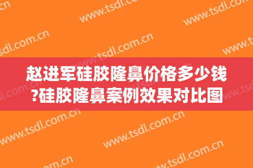 赵进军硅胶隆鼻价格多少钱?硅胶隆鼻案例效果对比图_温州医科大学附属第一医院