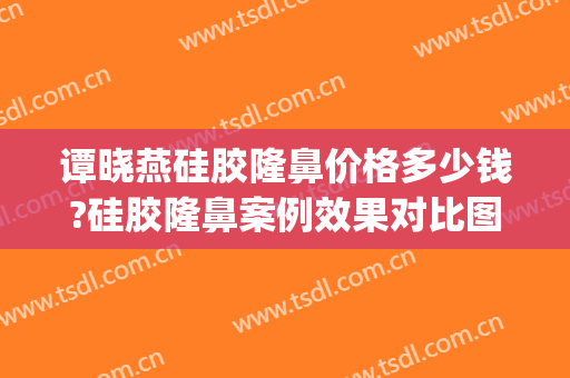 谭晓燕硅胶隆鼻价格多少钱?硅胶隆鼻案例效果对比图_杭州整形医院(硅胶隆鼻美容)