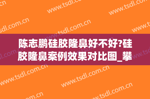 陈志鹏硅胶隆鼻好不好?硅胶隆鼻案例效果对比图_攀枝花市中西医结合医院