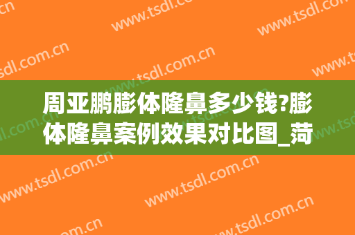 周亚鹏膨体隆鼻多少钱?膨体隆鼻案例效果对比图_菏泽市立医院(隆鼻膨体要多少钱)