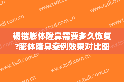 杨锴膨体隆鼻需要多久恢复?膨体隆鼻案例效果对比图_北京大学人民医院