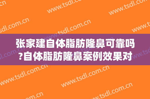 张家建自体脂肪隆鼻可靠吗?自体脂肪隆鼻案例效果对比图_四川省医学科学院·四川省人民医院