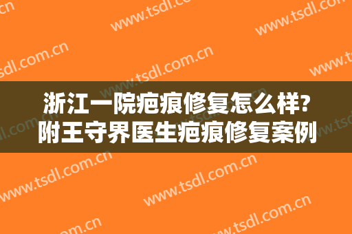 浙江一院疤痕修复怎么样?附王守界医生疤痕修复案例及价格