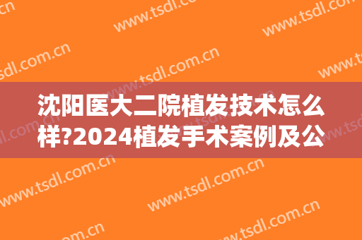 沈阳医大二院植发技术怎么样?2024植发手术案例及公布整形价位表(沈阳三甲医院植发)