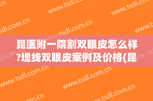 昆医附一院割双眼皮怎么样?埋线双眼皮案例及价格(昆明附二院肖鸿割双眼皮费用)