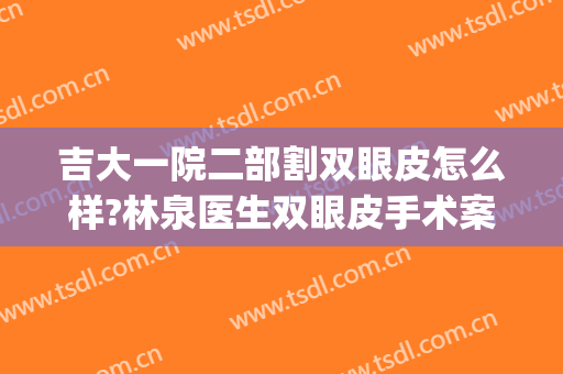 吉大一院二部割双眼皮怎么样?林泉医生双眼皮手术案例及价位表(吉大一院双眼皮哪个大夫做的好)