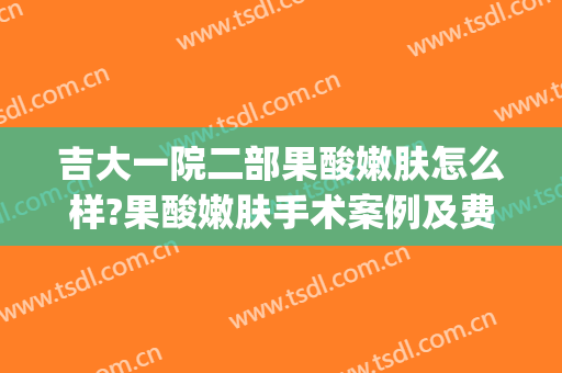 吉大一院二部果酸嫩肤怎么样?果酸嫩肤手术案例及费用公开(吉大二院果酸换肤)