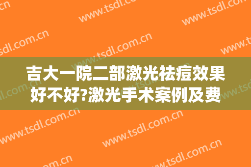 吉大一院二部激光祛痘效果好不好?激光手术案例及费用(吉大一院皮肤科点阵激光)