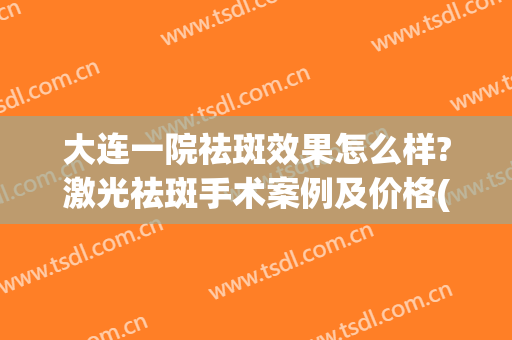 大连一院祛斑效果怎么样?激光祛斑手术案例及价格(大连哪家医院激光祛斑好)
