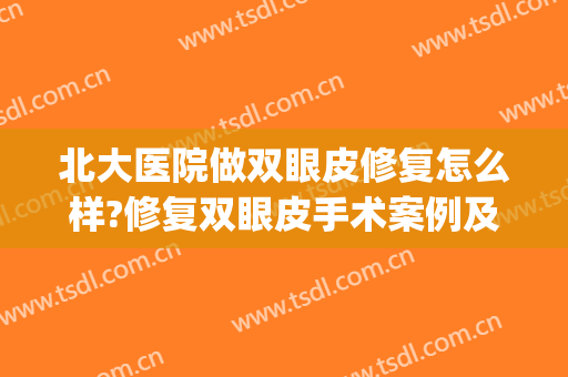 北大医院做双眼皮修复怎么样?修复双眼皮手术案例及价格(北京医院做双眼皮)