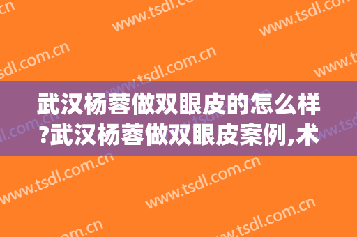 武汉杨蓉做双眼皮的怎么样?武汉杨蓉做双眼皮案例,术后恢复好!(武汉杨蓉做双眼皮好吗) 武汉杨蓉做双眼皮的怎么样?武汉杨蓉做双眼皮案例,术后恢复好!(武汉杨蓉做双眼皮好吗)