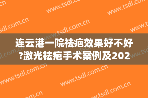 连云港一院祛疤效果好不好?激光祛疤手术案例及2024费用(连云港哪家医院激光祛除疤痕)