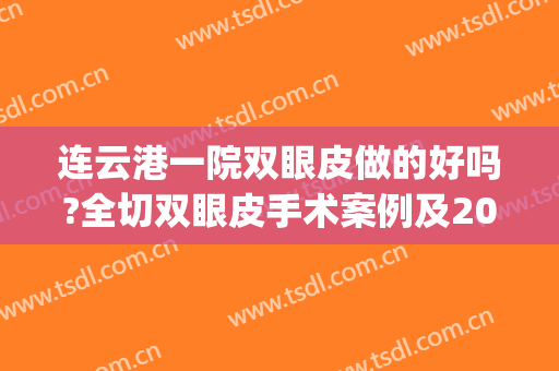 连云港一院双眼皮做的好吗?全切双眼皮手术案例及2024价格(连云港第一人民医院做双眼皮好吗)