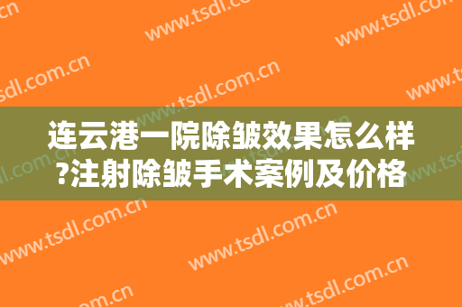连云港一院除皱效果怎么样?注射除皱手术案例及价格