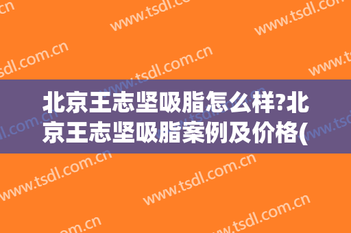 北京王志坚吸脂怎么样?北京王志坚吸脂案例及价格(北京吸脂专家)