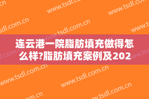 连云港一院脂肪填充做得怎么样?脂肪填充案例及2024价格