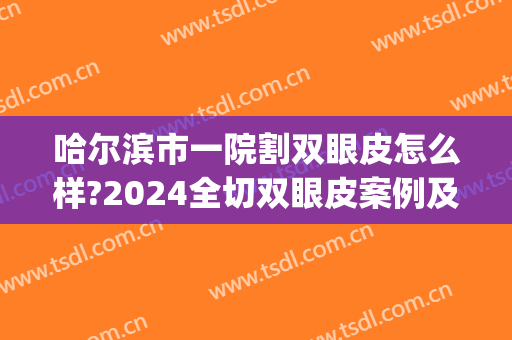 哈尔滨市一院割双眼皮怎么样?2024全切双眼皮案例及价格(哈尔滨医院割双眼皮多少钱)