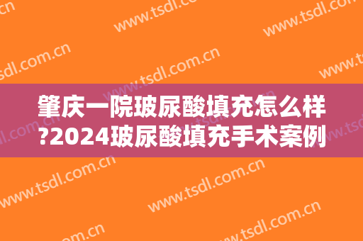 肇庆一院玻尿酸填充怎么样?2024玻尿酸填充手术案例及价格