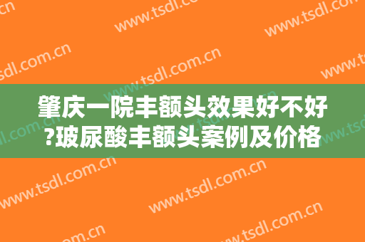 肇庆一院丰额头效果好不好?玻尿酸丰额头案例及价格