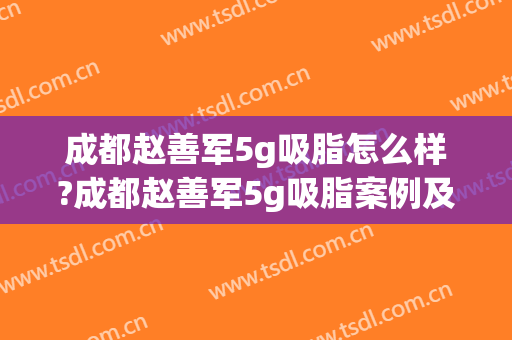 成都赵善军5g吸脂怎么样?成都赵善军5g吸脂案例及价格