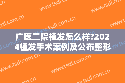 广医二院植发怎么样?2024植发手术案例及公布整形价位表