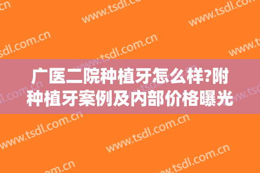 广医二院种植牙怎么样?附种植牙案例及内部价格曝光(二甲医院种植牙)