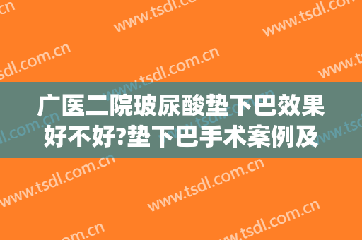 广医二院玻尿酸垫下巴效果好不好?垫下巴手术案例及2024整形价目(玻尿酸垫下巴副作用)