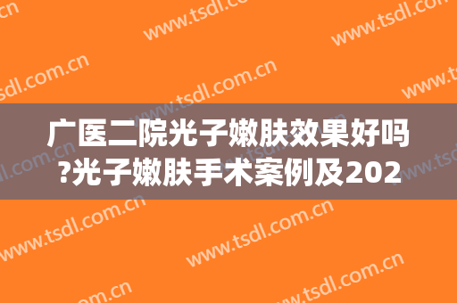 广医二院光子嫩肤效果好吗?光子嫩肤手术案例及2024全新价位表(二甲医院做光子嫩肤)