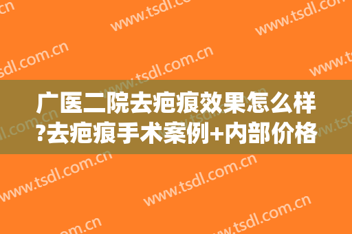 广医二院去疤痕效果怎么样?去疤痕手术案例+内部价格(去疤痕广州医院好呢)