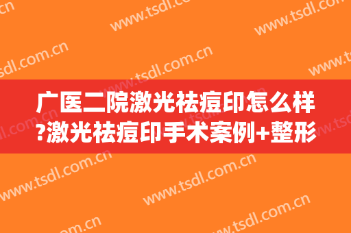 广医二院激光祛痘印怎么样?激光祛痘印手术案例+整形收费标准(广州激光去痘印最好的医院)