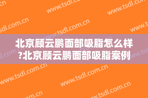 北京顾云鹏面部吸脂怎么样?北京顾云鹏面部吸脂案例,脸部轮廓明显!