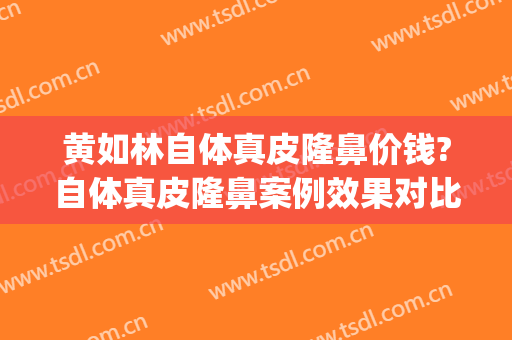 黄如林自体真皮隆鼻价钱?自体真皮隆鼻案例效果对比图_上海交通大学医学院附属第九人民医院