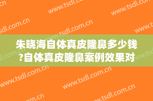 朱晓海自体真皮隆鼻多少钱?自体真皮隆鼻案例效果对比图_海军军医大学第二附属医院