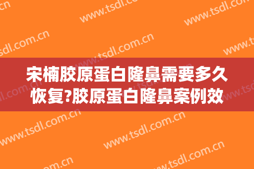 宋楠胶原蛋白隆鼻需要多久恢复?胶原蛋白隆鼻案例效果对比图_复旦大学附属眼耳鼻喉科医院