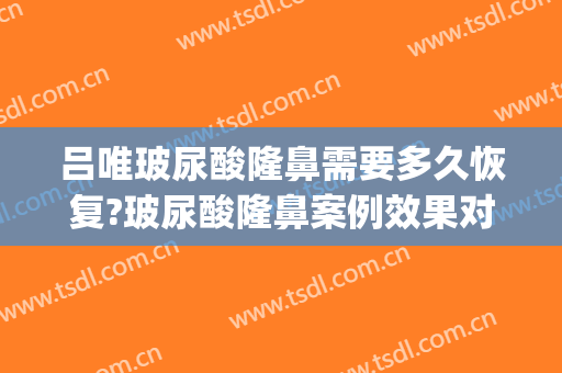 吕唯玻尿酸隆鼻需要多久恢复?玻尿酸隆鼻案例效果对比图_中国医学科学院整形外科医院
