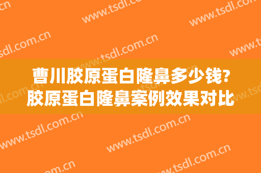 曹川胶原蛋白隆鼻多少钱?胶原蛋白隆鼻案例效果对比图_陆军军医大学第一附属医院