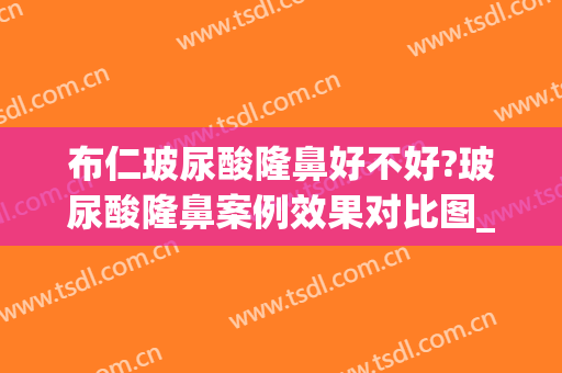 布仁玻尿酸隆鼻好不好?玻尿酸隆鼻案例效果对比图_好大夫工作室(玻尿酸隆鼻子效果好吗)