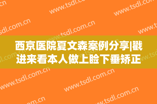 西京医院夏文森案例分享|戳进来看本人做上睑下垂矫正全部过程图吧!