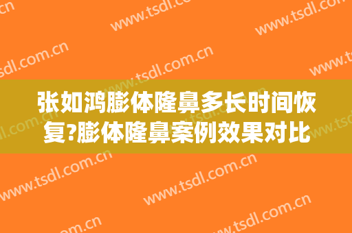 张如鸿膨体隆鼻多长时间恢复?膨体隆鼻案例效果对比图_上海交通大学医学院附属第九人民医院