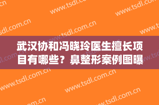 武汉协和冯晓玲医生擅长项目有哪些？鼻整形案例图曝光！附价格(协和冯晓玲双眼皮案例)