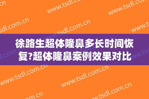 徐路生超体隆鼻多长时间恢复?超体隆鼻案例效果对比图_佛山市第一人民医院
