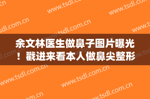 余文林医生做鼻子图片曝光！戳进来看本人做鼻尖整形前后对比图吧！(文丰整形医生鼻子图片)