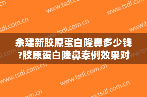 余建新胶原蛋白隆鼻多少钱?胶原蛋白隆鼻案例效果对比图_浙江大学医学院附属第二医院