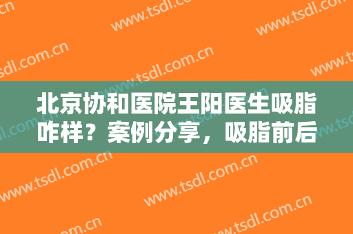 北京协和医院王阳医生吸脂咋样？案例分享，吸脂前后大变样！附价格表