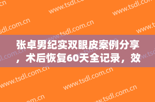 张卓男纪实双眼皮案例分享，术后恢复60天全记录，效果超自然！(石家庄张卓男割双眼皮)