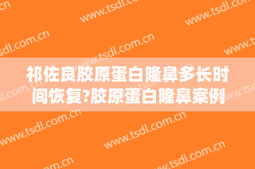 祁佐良胶原蛋白隆鼻多长时间恢复?胶原蛋白隆鼻案例效果对比图_中国医学科学院整形外科医院