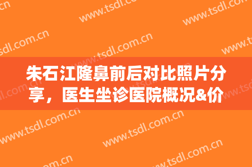 朱石江隆鼻前后对比照片分享，医生坐诊医院概况&价格表2024(朱石江隆鼻案例)