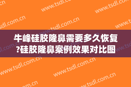 牛峰硅胶隆鼻需要多久恢复?硅胶隆鼻案例效果对比图_中国医学科学院整形外科医院