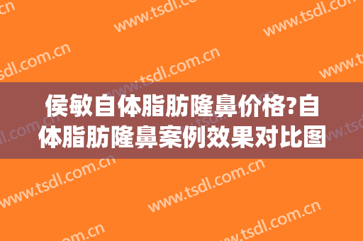 侯敏自体脂肪隆鼻价格?自体脂肪隆鼻案例效果对比图_天津市口腔医院